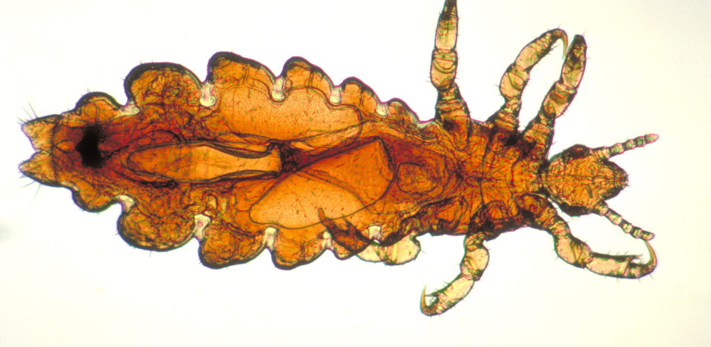 Picture of Body Lice - WebMD